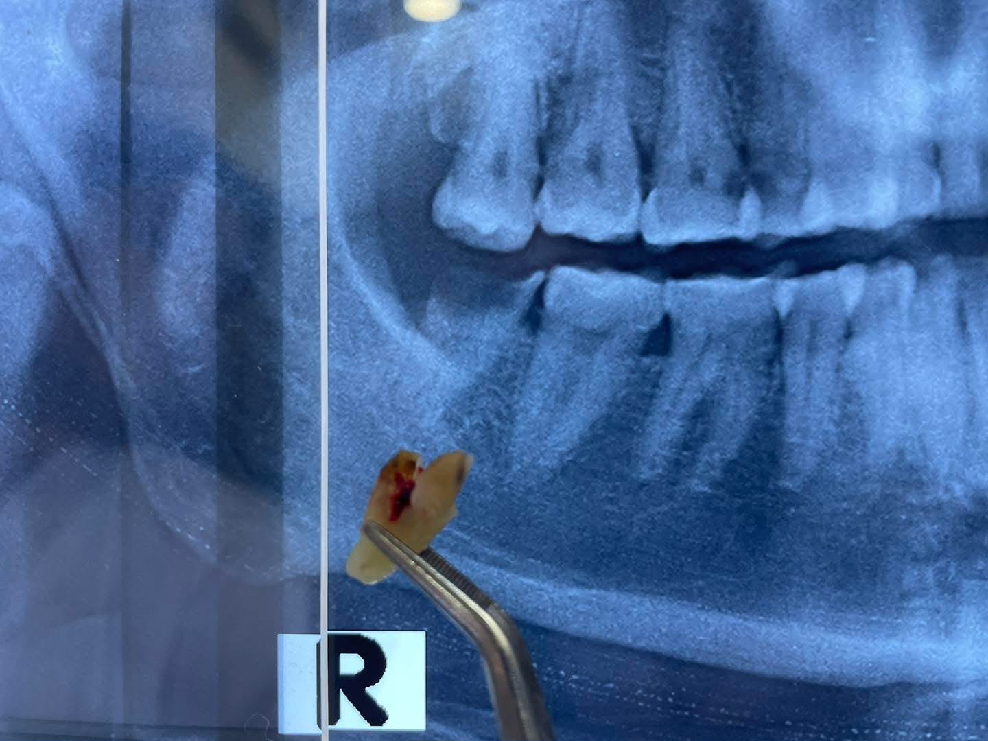 Successful dental treatment results